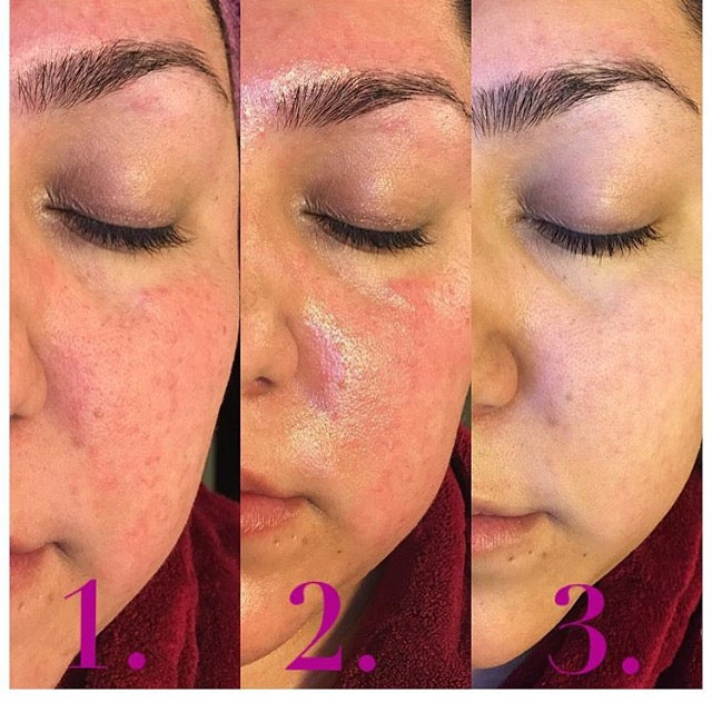 Boo-Boo Gel, Natural & Organic