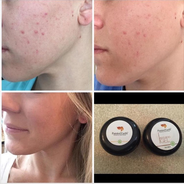 Boo-Boo Gel, Natural & Organic