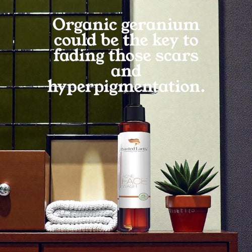 Acne/Sensitive Face Wash