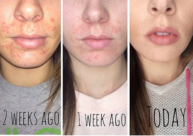 Boo-Boo Gel, Natural & Organic